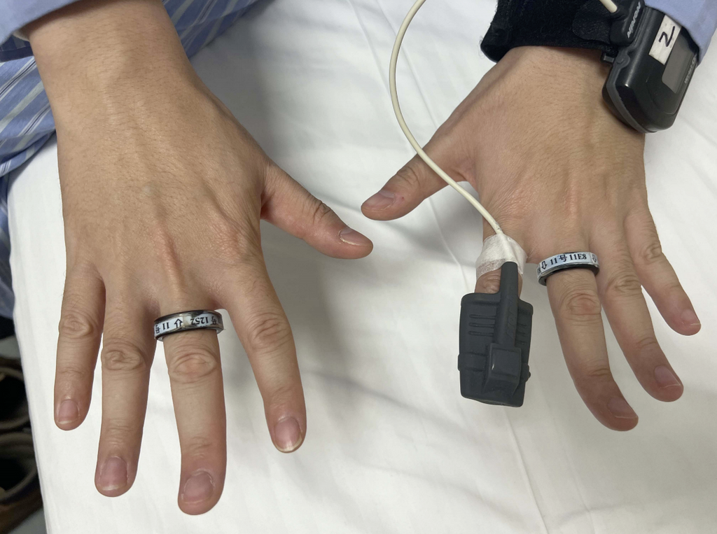 RingConn 智能環和手指夾脈衝血氧儀
